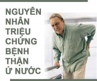 Nguyên nhân và triệu chứng bệnh thận ứ nước