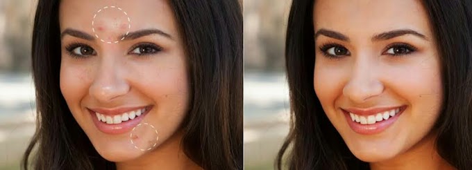 6 natural treatments to remove facial blemishes
