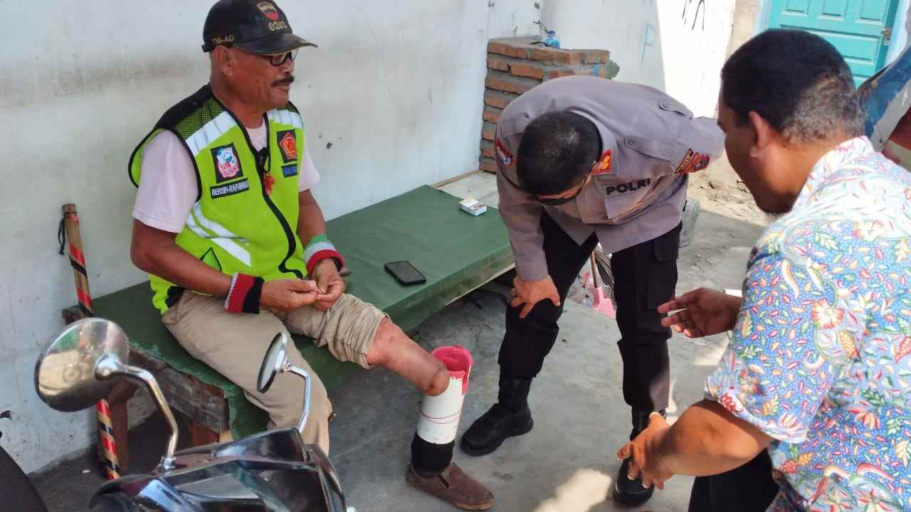 Polrestabes Medan Sambangi Warga yang Membutuhkan Kaki Palsu