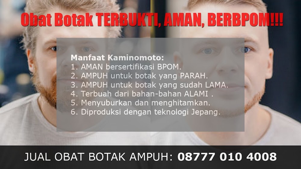 jual OBAT PENUMBUH RAMBUT BOTAK Pemalang<br/>