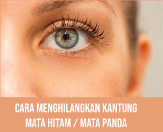 Cara menghilangkan kantung mata hitam / mata panda