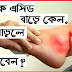 রক্তে ইউরিক এসিড বেড়ে গেলে কীভাবে বুঝবেন এবং প্রতিরোধে কী করবেন? -  Uric Acid