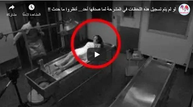 لو لم يتم تسجيل هذه اللحظات في المشرحة لما صدقها أحد... أنظروا ما حدث !!