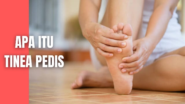 Apa Itu Tinea Pedis Pada Manusia Tinea pedis atau yang disebut juga athlete’s foot adalah salah satu infeksi jamur superfisial pada kulit kaki yang sering terjadi pada kasus dermatofitosis umumnya saat ini (William et al., 2016). Diperkirakan sekitar 70% populasi di seluruh dunia telah terinfeksi tinea pedis. Tingkat insidensi tinea pedis pada dewasa secara signifikan lebih banyak daripada tinea pedis pada anak – anak dan lebih banyak pada pria daripada wanita (Behzadi et al., 2014). Tinea pedis biasanya disebabkan tersering oleh Trichophyton rubrum atau Trichophyton mentagrophytes, kadang juga disebabkan oleh Epidermophyton floccosum dan Microsporum namun sangat jarang sekali. Secara garis besar gejala klinis tinea pedis dikelompokkan menjadi tipe interdigital, tipe vesicular, tipe moccasin (Andrew, 2013).    Nah itu dia bahasan dari apa itu tinea pedis pada manusia, melalui bahasan di atas bisa diketahui mengenai apa itu tinea pedis pada manusia. Mungkin hanya itu yang bisa disampaikan di dalam artikel ini, mohon maaf bila terjadi kesalahan di dalam penulisan, dan terimakasih telah membaca artikel ini."God Bless and Protect Us"