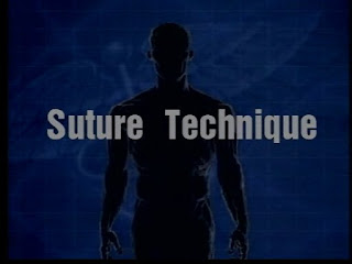 Suture Technique