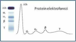 Protein elektroforezi
