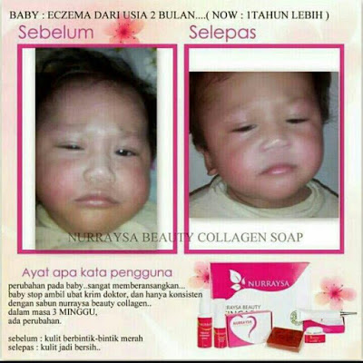 NURRAYSA COLLAGEN SOAP