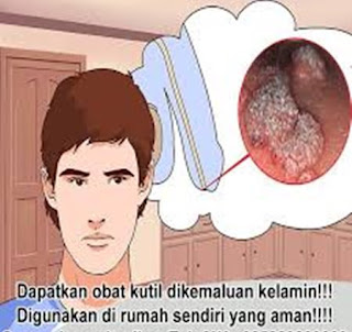 Obat kutil kelamin yg di jual di apotik, obat kutil kelamin di apotek, obat kutil kelamin atau kutil di kemaluan ampuh tanpa operasi, obat kutil kelamin paling efektif, obat kutil kelamin aman buat ibu hamil, obat kutil kelamin tradisional yg mujarab, kutil kelamin atau kutil di kemaluan wanita, obat manjur kutil kelamin atau kutil di kemaluan, mengobati kutil kelamin atau kutil di kemaluan wanita, pengobatan kutil di kemaluan, kutil pada rambut kelamin