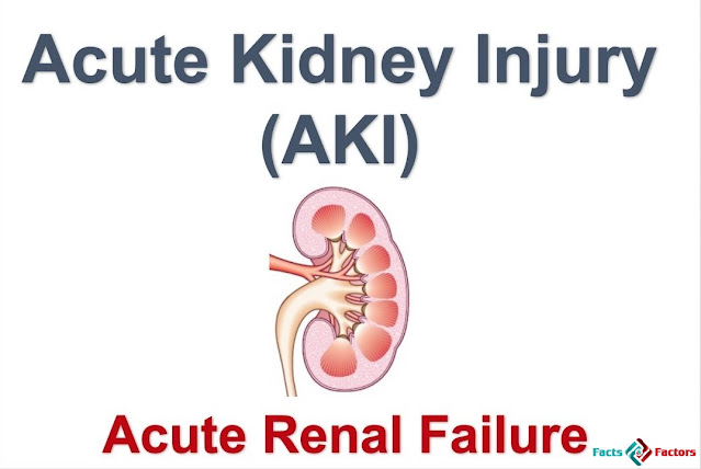 Global Acute Kidney Injury Treatment Market