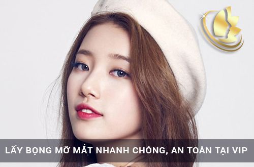 Lấy bọng mỡ mắt nhanh chóng, an toàn tại VIP