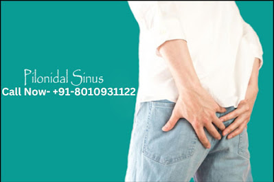 Non-Surgical Pilonidal Sinus Treatment in Gurugram: Get Relief Without Going Under the Knife!