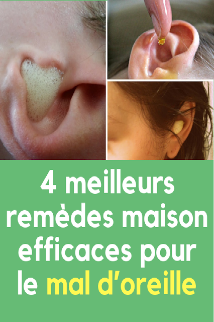 Douleur-oreille-traitements-naturels