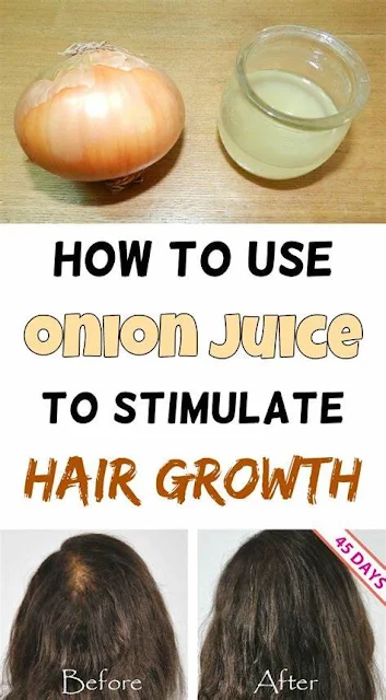 How Onion Helps in Hair Growth