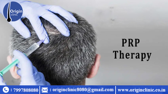 https://originclinic.co.in/hairloss.html