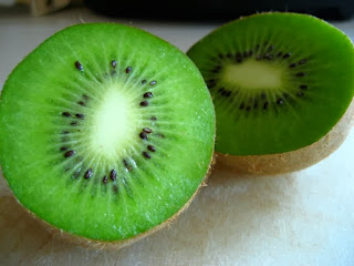 Manfaat Buah Kiwi