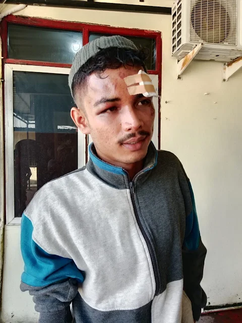 Pinjam Handphone Pacar Hingga Dua Minggu, Seorang Pemuda Dikeroyok OTK di SP Sagulung Batam