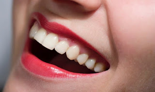 how-to-clean-teeths-for-best-smile