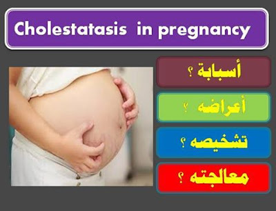 حالة Cholestatasis in pregnancy 