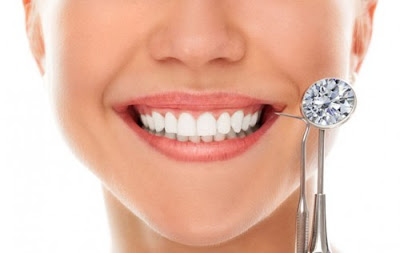 Đính kim cương vào răng có hại không?