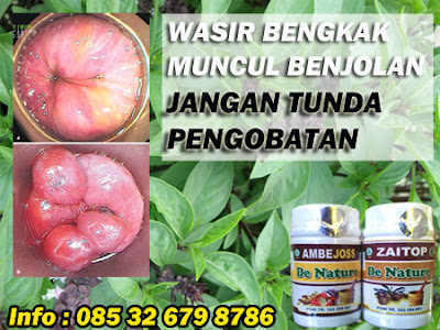 Obat Ambeien Berdarah Pada Wanita Hamil