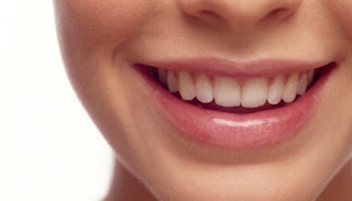 Cara Sederhana Memutihkan Gigi