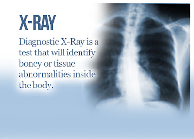 What Is X-ray 