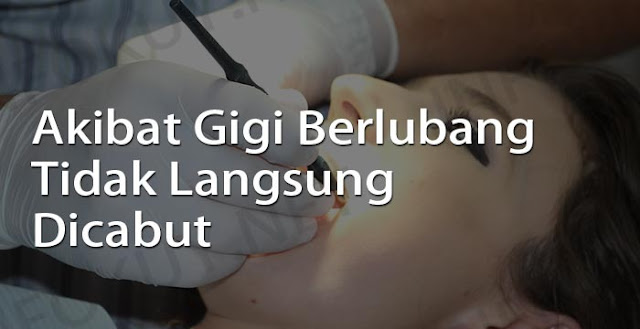 akibat gigi berlubang tidak langsung dicabut