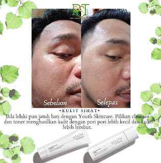 Testimoni Youth Skincare Shaklee Untuk Kulit Muka Lelaki