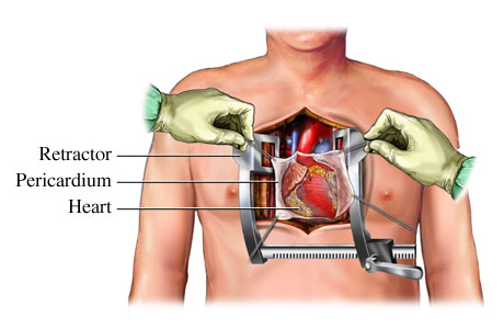 The+human+heart+diagram