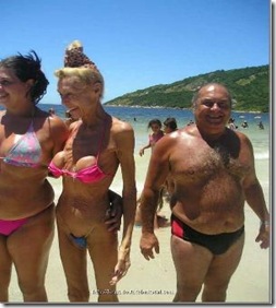 old-breast-implants1
