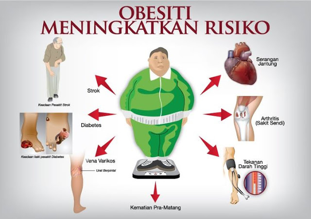 Ubat Kurus Paling Berkesan & Produk Untuk Kuruskan Badan