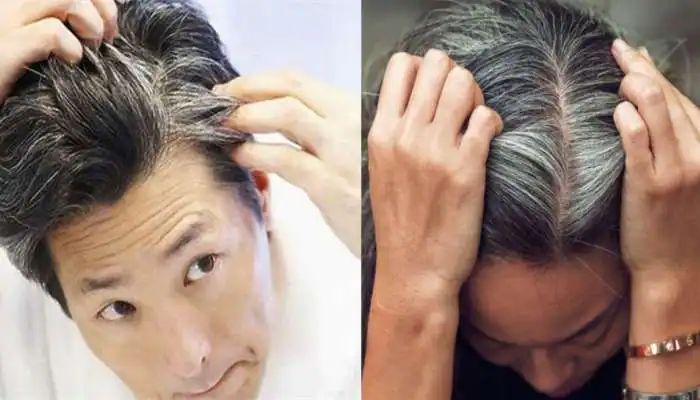 gray hair in young age,gray-hair-becoming-excessive-by-the-age-of-30