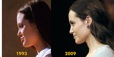 Angelina Jolie Plastic Surgery Before And After