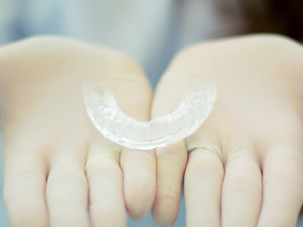 What Happens if you Don’t wear Your Invisalign? 