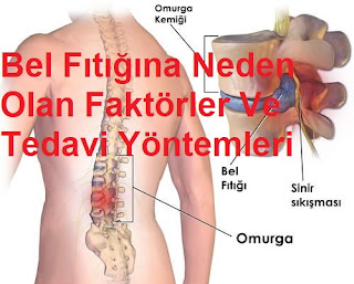 Bel Fıtığına Neden Olan Faktörler Ve Tedavi Yöntemleri