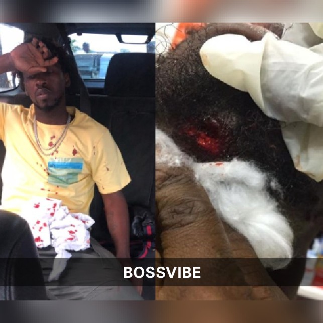 Photos: Orezi survives car crash, suffers 'broken jaw'