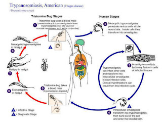 Is Chagas Disease the New AIDS