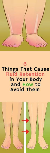 6 Things That Cause Fluid Retention in Your Body and How to Avoid Them!