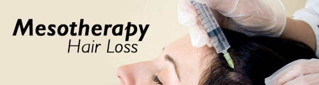 Hair fall treatment in Indirapuram