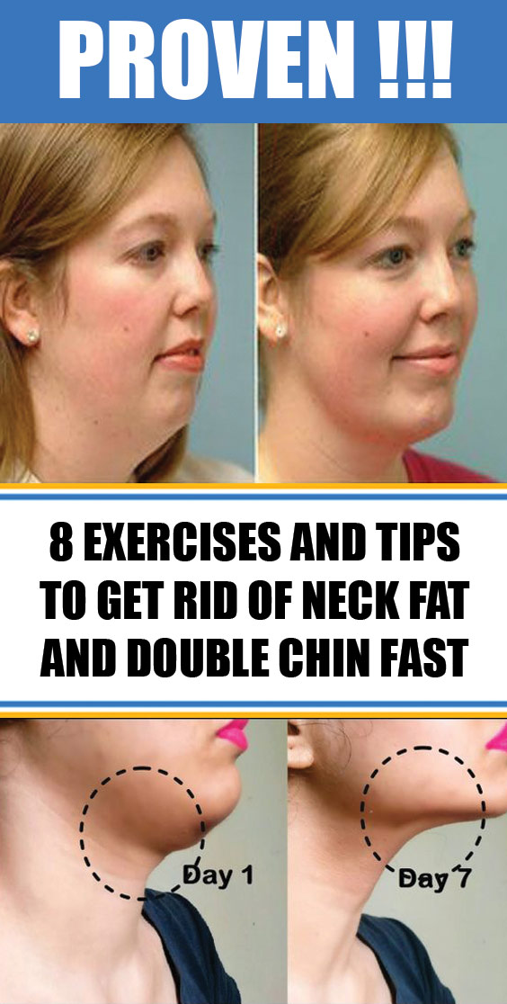 8 Exercises And Tips To Get Rid Of Neck Fat And Double Chin Fast #facexercises #getridofneckfat
