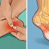 How to treat and prevent plantar fasciitis at home