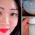 Botox japonés casero para quitar 20 años de arrugas y blanquear el rostro instantáneamente.