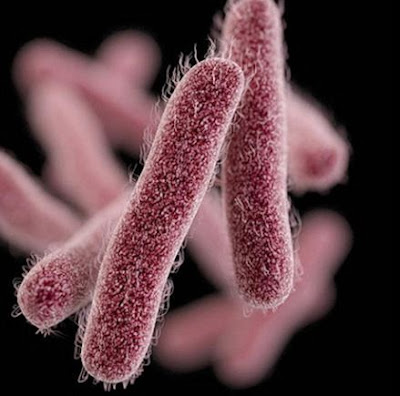 Shigellosis: Causes, Symptoms, Treatment and Prevention