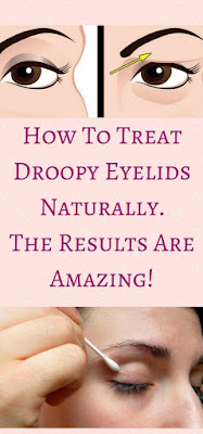 HOW TO TREAT DROOPY EYELIDS NATURALLY. THE RESULTS ARE AMAZING!