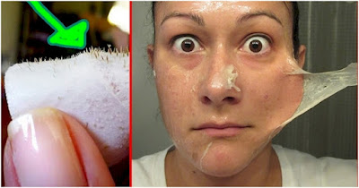 How To Make Your Own Blackhead Strips With Just TWO Ingredients