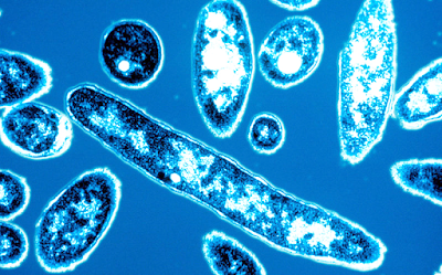 Legionella Pneumophila – A doença do Legionário