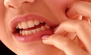 Easy way to cure cavities for overcoming pain