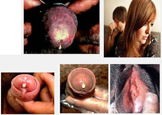 Obat Untk Kencing Nanah, obat kapsul kencing nanah, kencing nanah mengakibatkan, kemaluan pria bernanah, obat sipilis secara tradisional, buah obat gonore (kencing nanah)