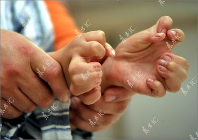 Unbelievable - Chinese Boy With 34 Fingers