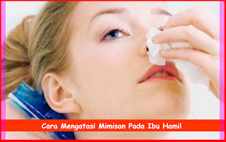 Cara Mengatasi Mimisan Pada Ibu Hamil